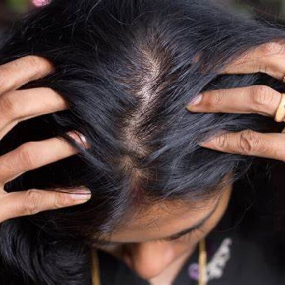 Likwid RX 100% Natural Hair Oil - Picture 3 of 9